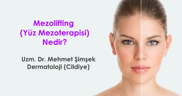 Mezolifting (Yüz Mezoterapisi) Nedir?